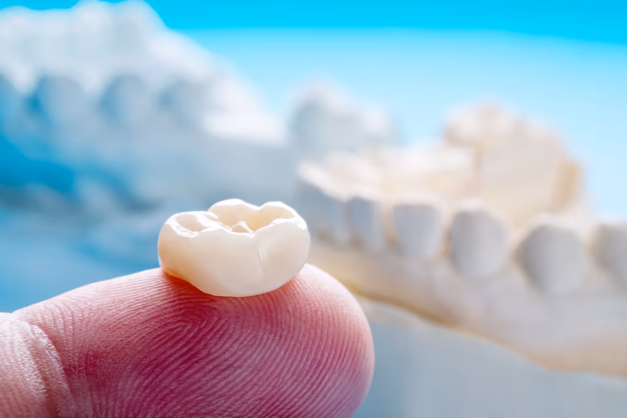 Cosmetic Crowns in Allen, TX