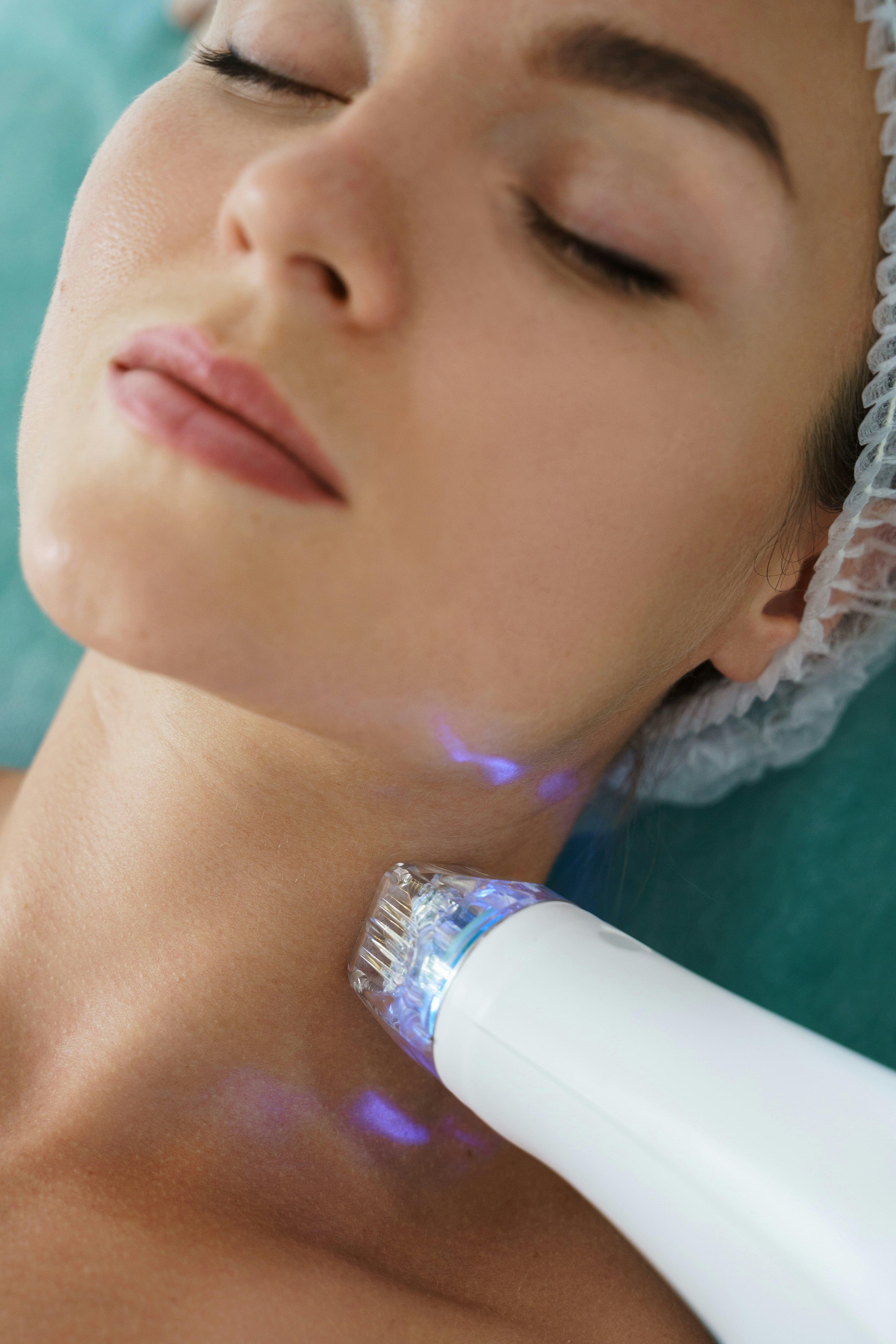 Microneedling-behandling på halsen hos Magic Touch Beauty