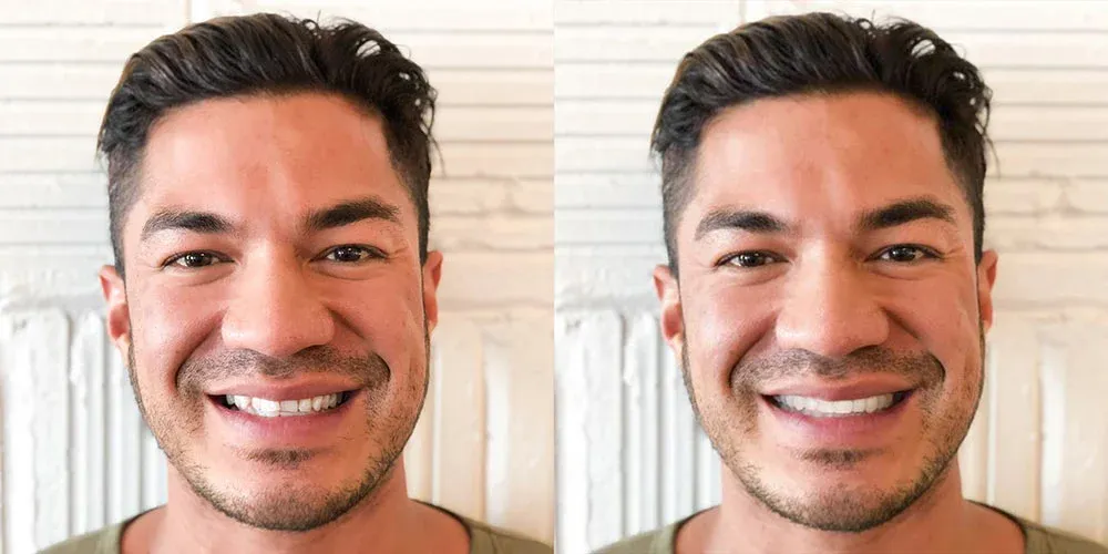 Side-by-side close-ups of a man smiling, showing a comparison of his teeth.