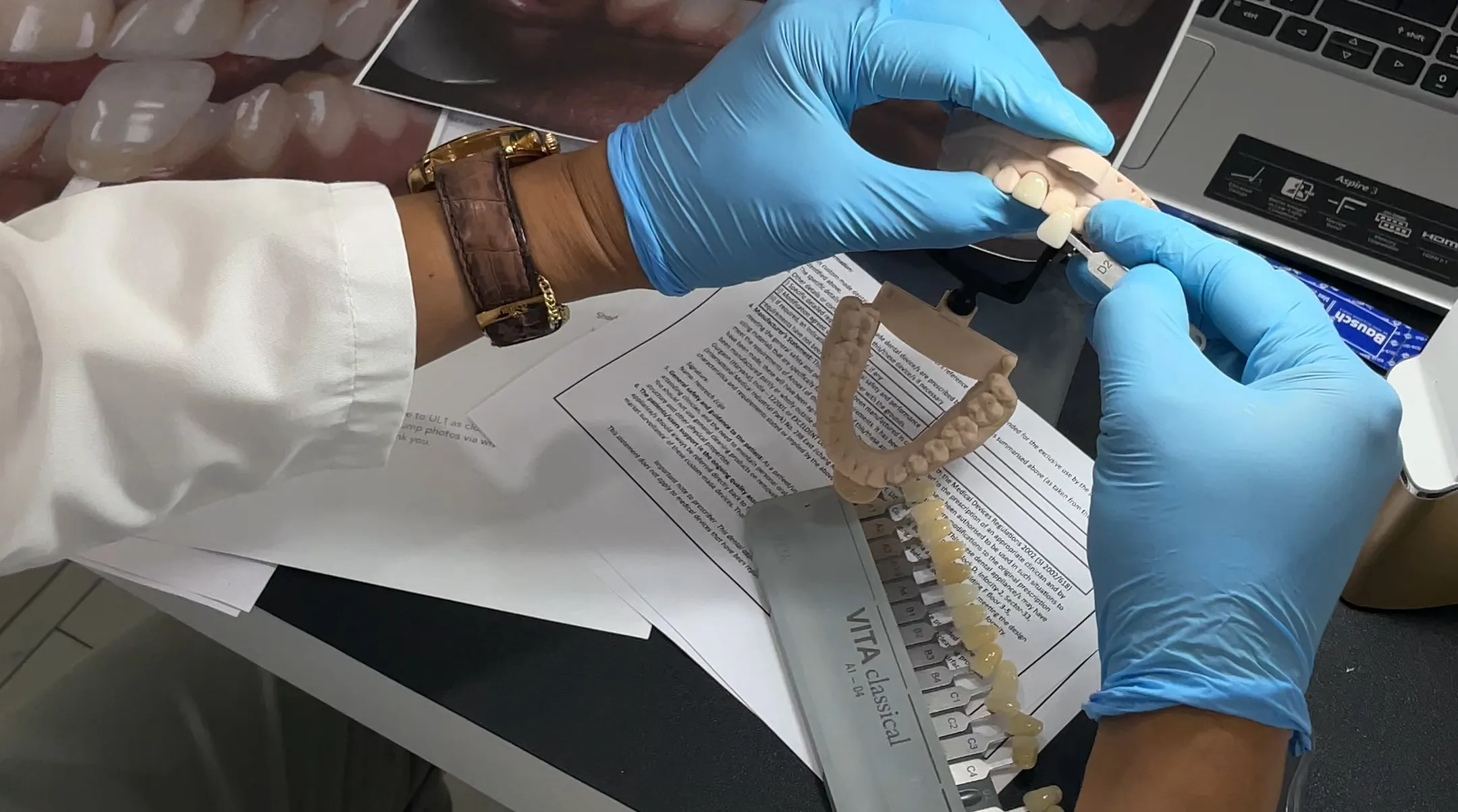 Person wearing blue gloves holding a dental mold and shade guide for teeth color matching over a desk with documents and a laptop.