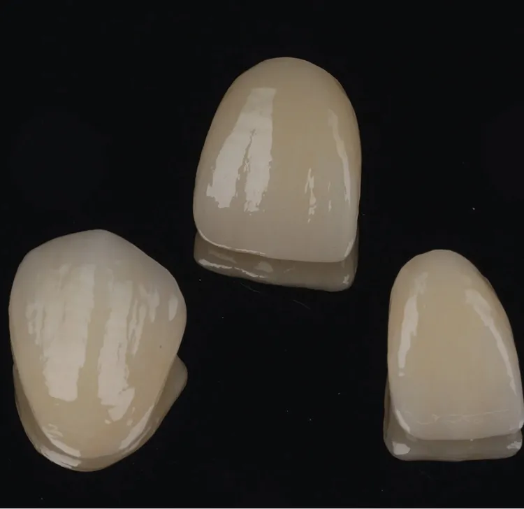 Three glossy dental crowns on a black background.