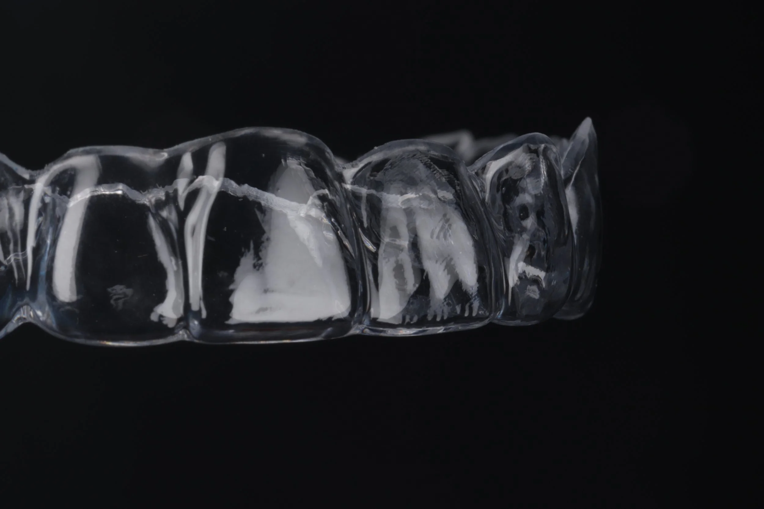 Close-up of a clear dental aligner against a black background.