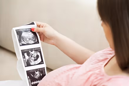 Pregnant Woman looking at ultrasound