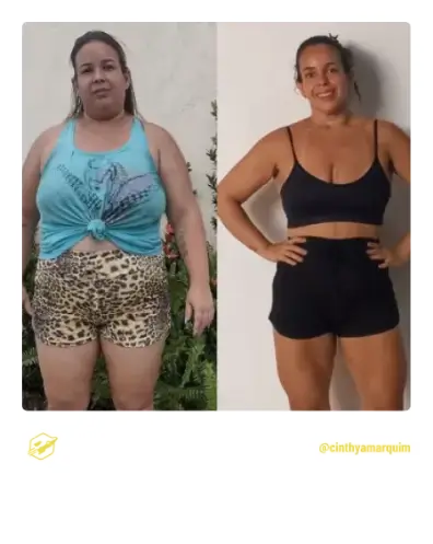 Antes e Depois Cinthya Marquim