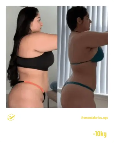 Antes e Depois Amanda Farias