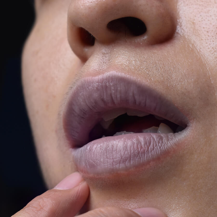 Blue tinged lips