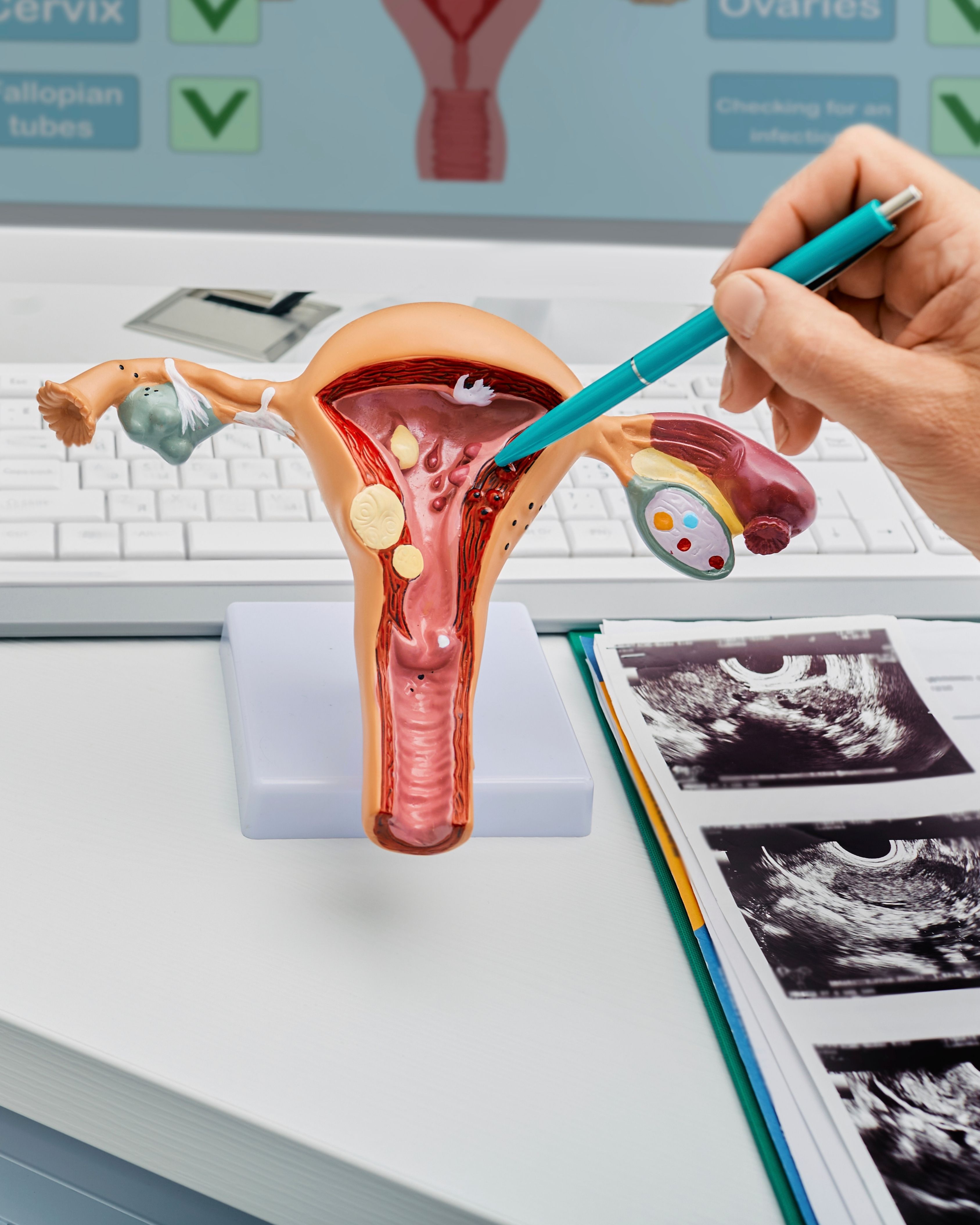 Medical model of a female reproductive system with a hand pointing to the uterine lining using a pen, on a desk with ultrasound images and a keyboard in the background.