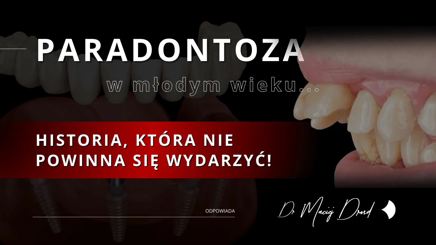 paradontoza-w-mlodym-wieku