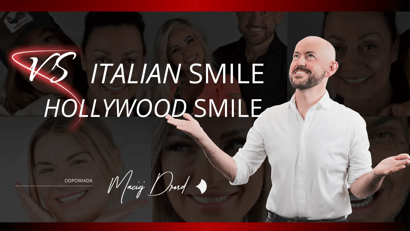 hollywood-smile-vs-italian-smile