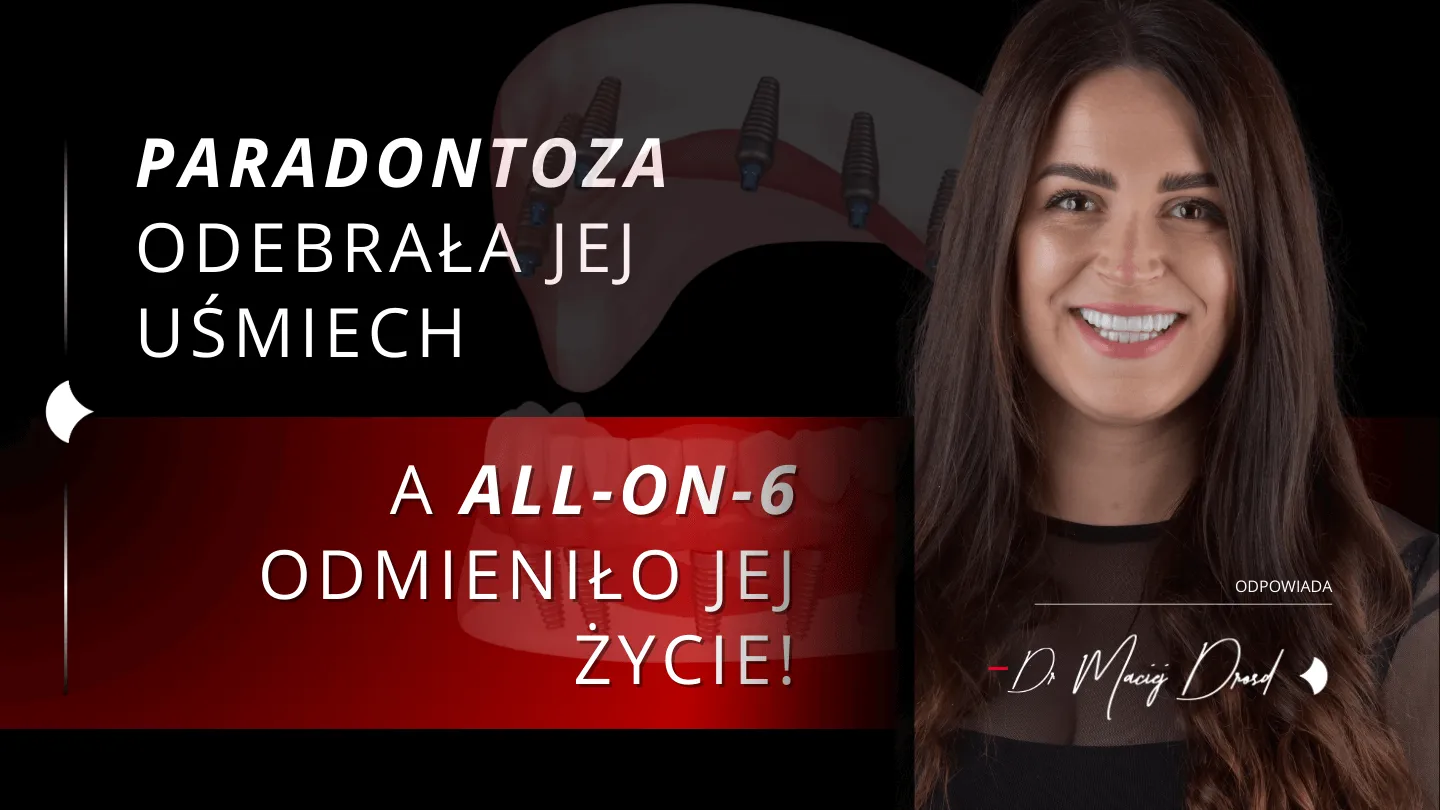 paradontoza-all-on-6