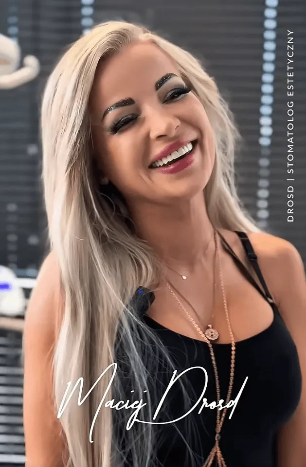 magda-licowki-3-dzien-metamorfozy