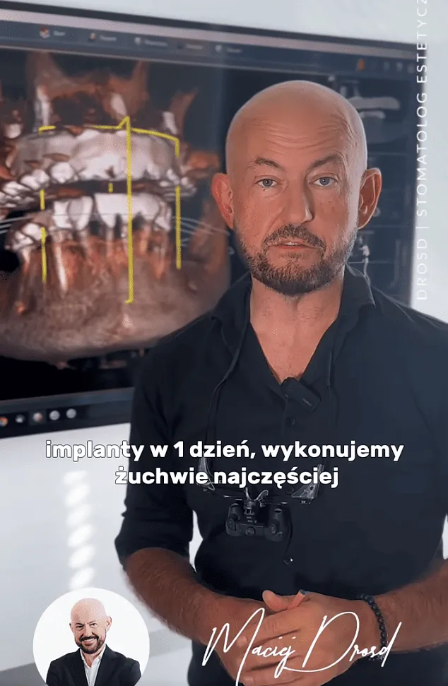 implanty-w-jeden-dzien