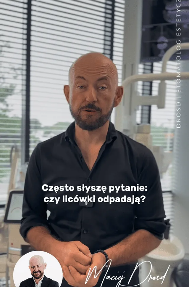 czy-licowki-odpadaja