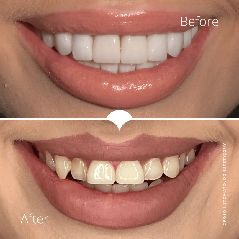 joanna-nowakowska-metamorfoza-licowki-dr-drosd