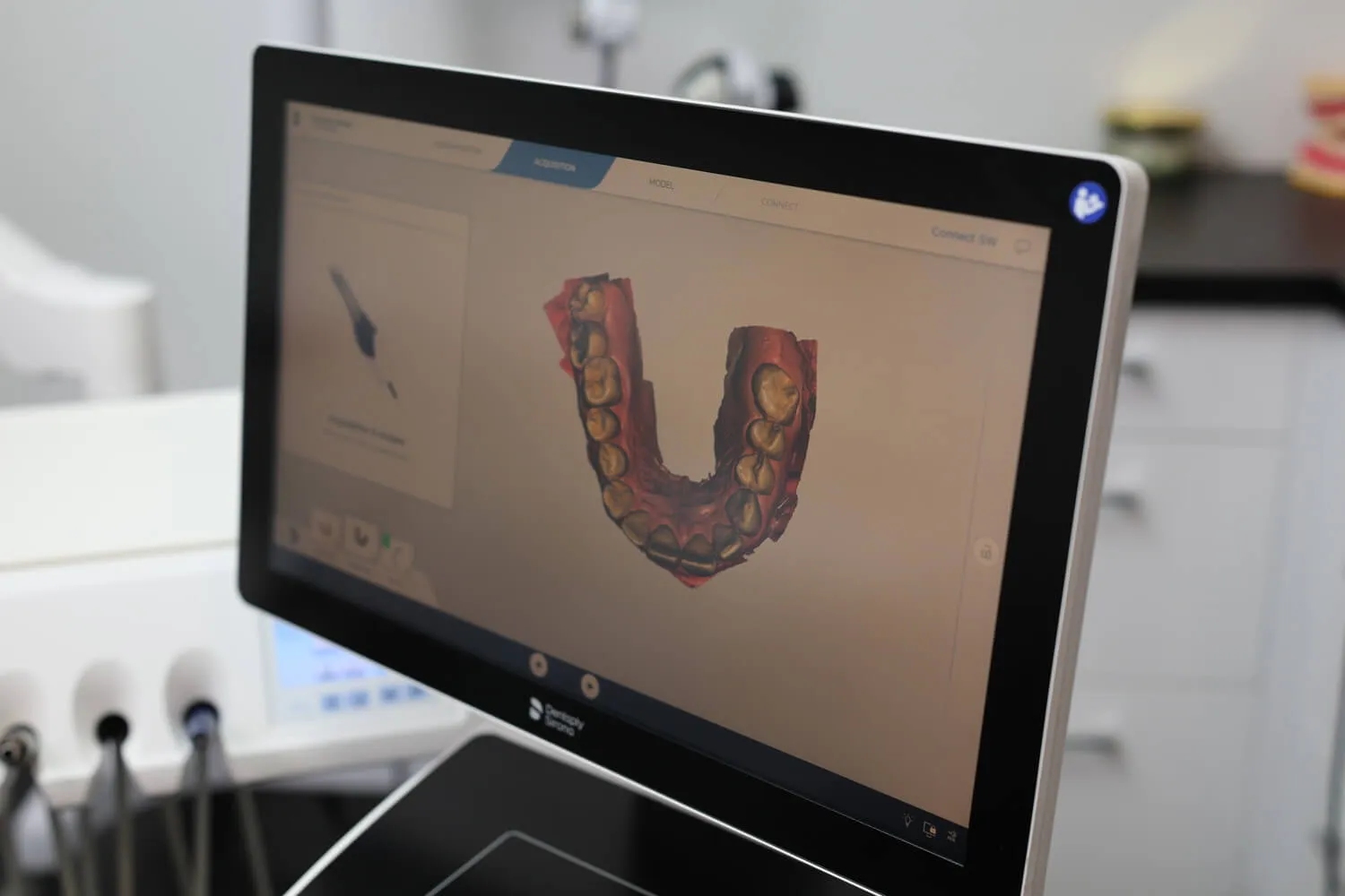 Skan 3D przed implantami - diagnostyka cyfrowa w gabinecie Dental Camp Toruń