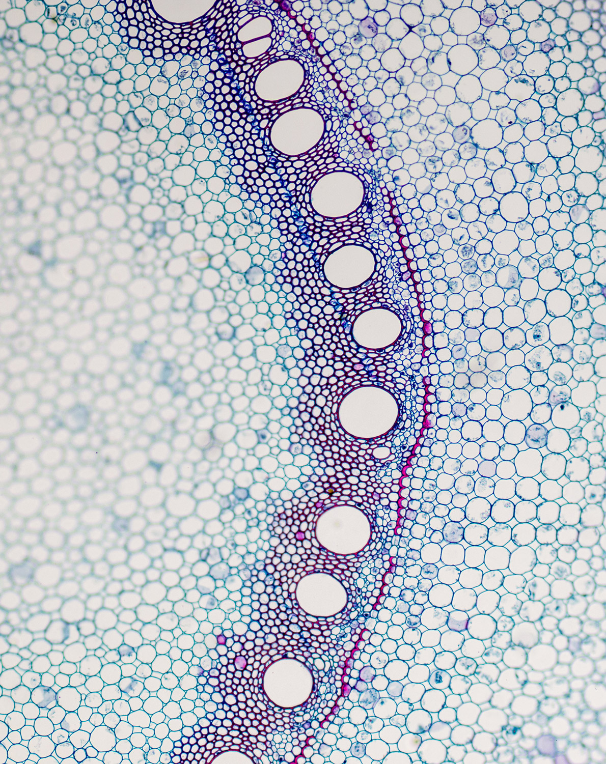 Mikroskopbilde av plantevev som viser cellestrukturer med store sirkulære celler i midten og mindre celler rundt.