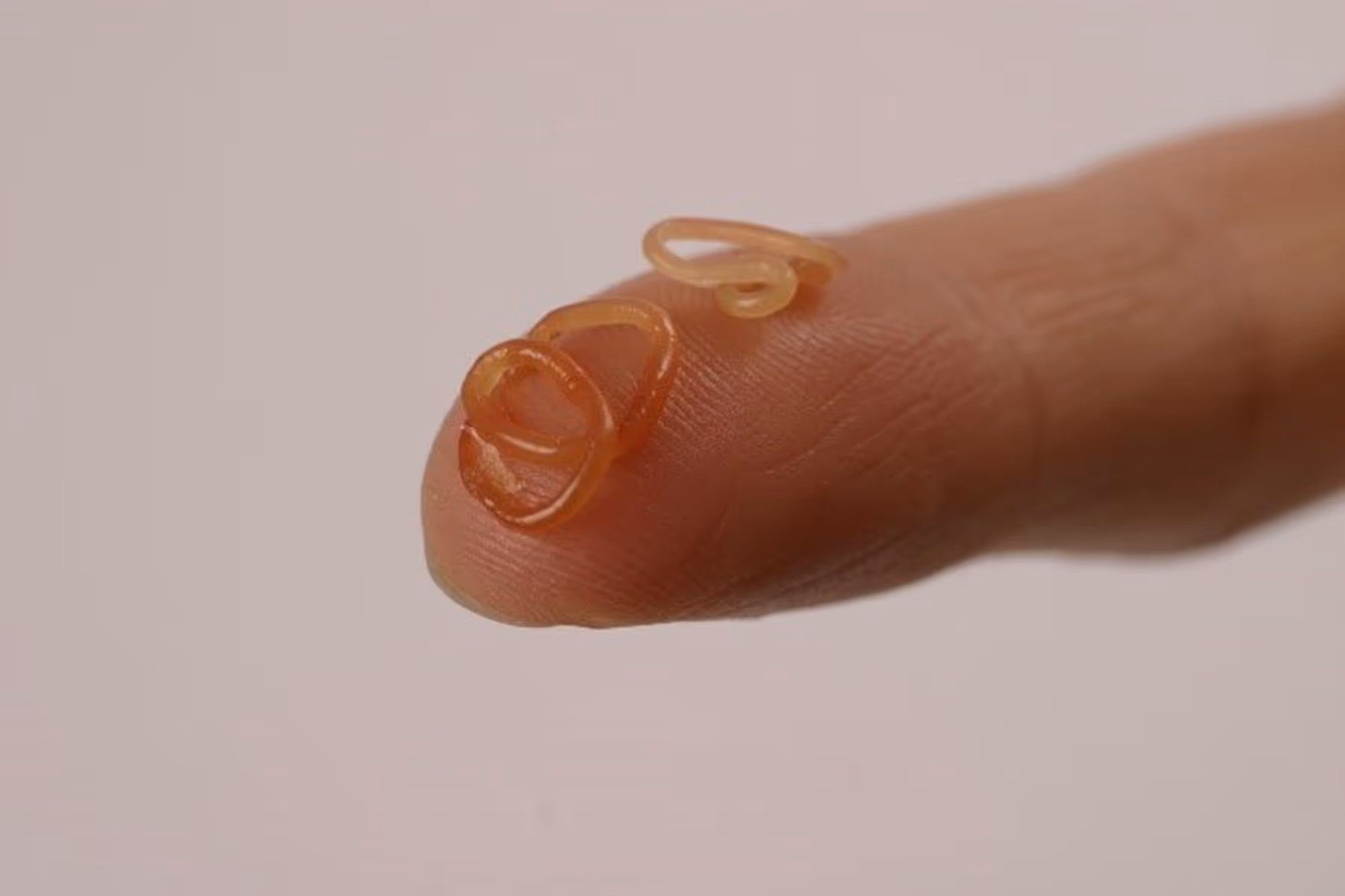 Two tiny parasitic worms coiled on the tip of a human finger against a plain background.
