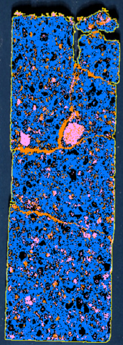 Type A Classification