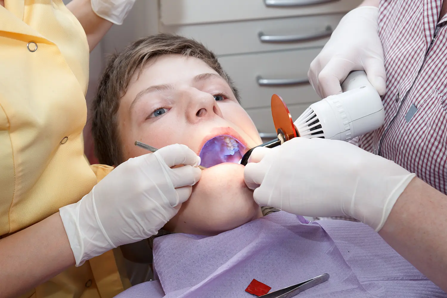 Restorative Dentistry for Kids in Edmond, OK | Combs Pediatric Dentistry
