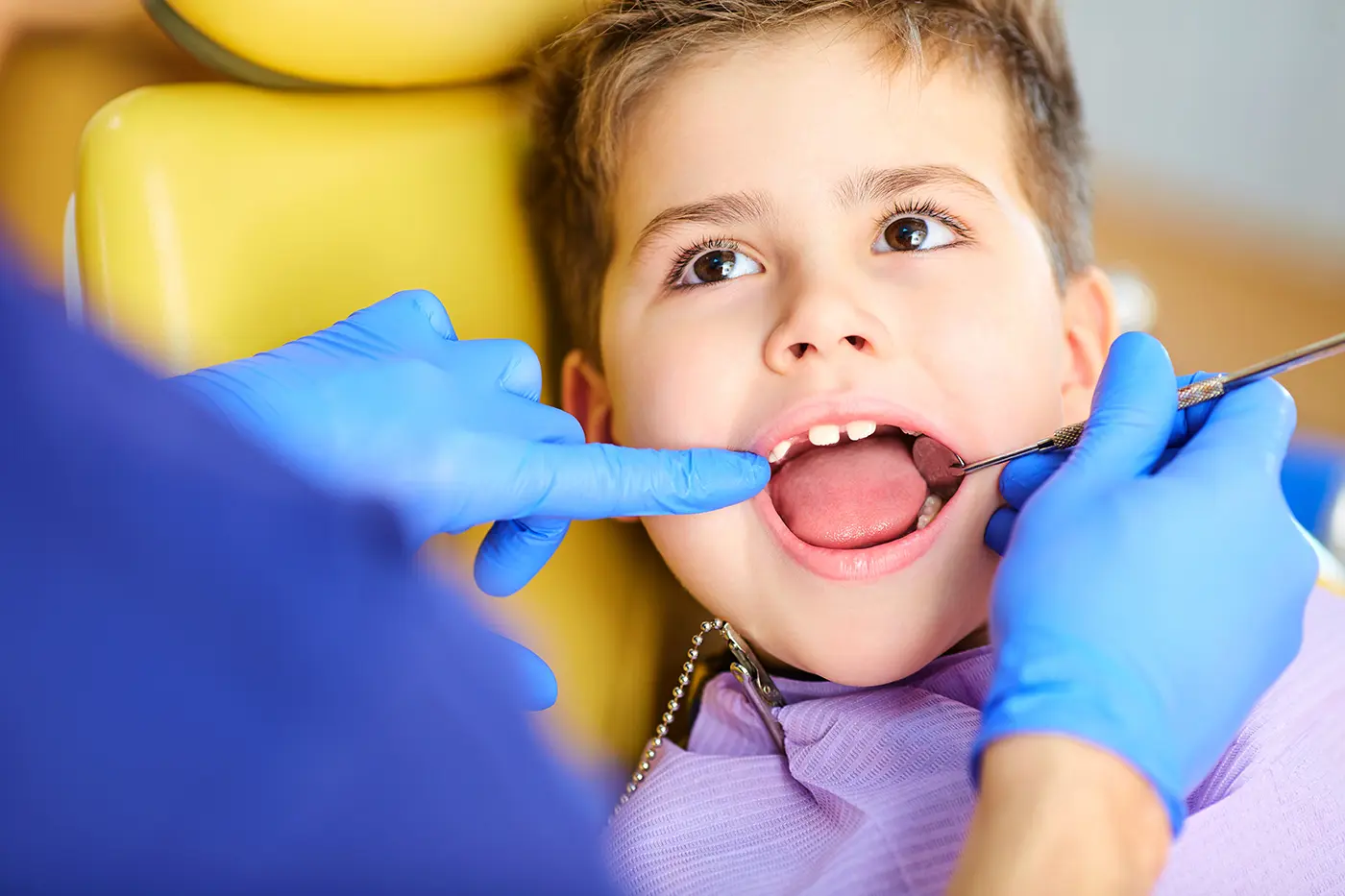 Gentle Tooth Extractions for Children in Edmond, OK | Combs Pediatric Dentistry