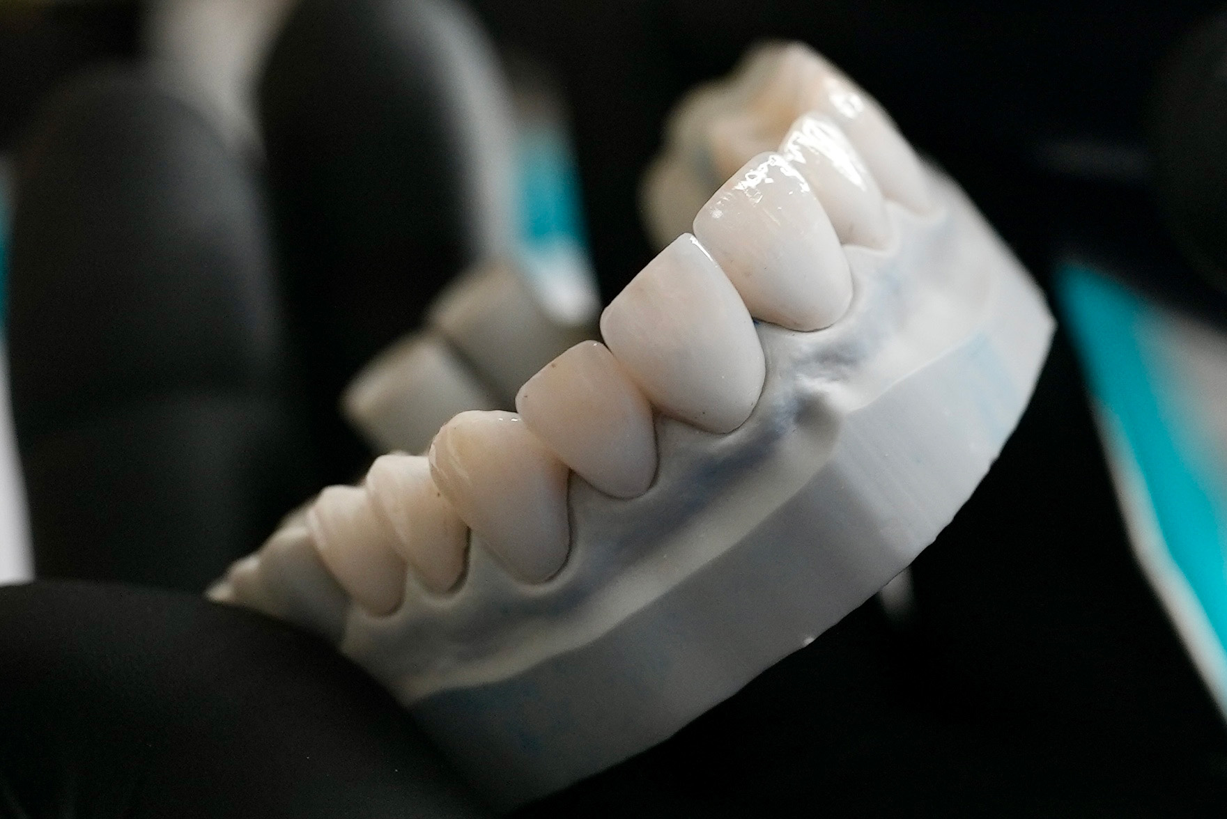 Close-up of a dental mold with artificial teeth held by a gloved hand.