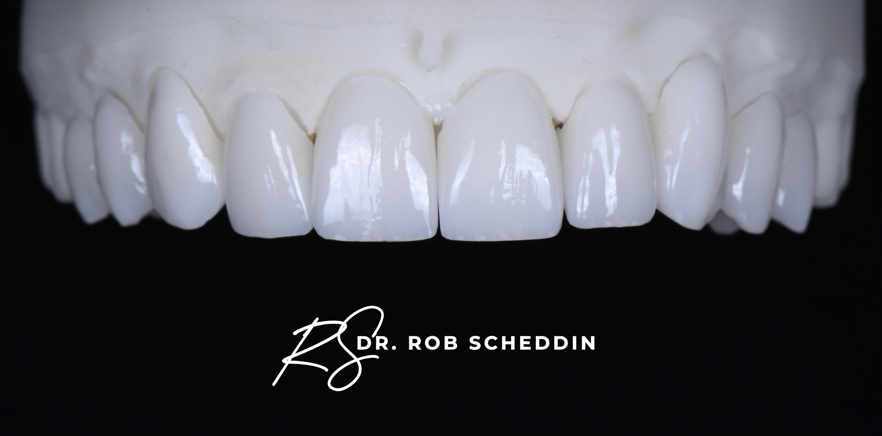 Close-up of a dental model showing a set of white upper teeth on a black background with the text 'DR. ROB SCHEDDIN'.