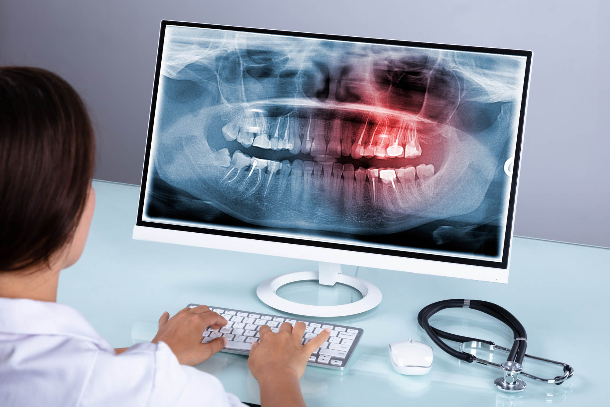 female dentist looking at teeth xray on computer 