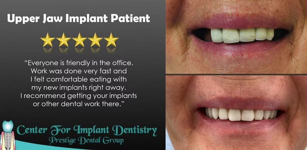 Dental implant patient testimonial on dental landing page.