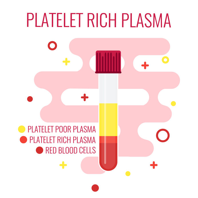 Paletet-Rich Plasma