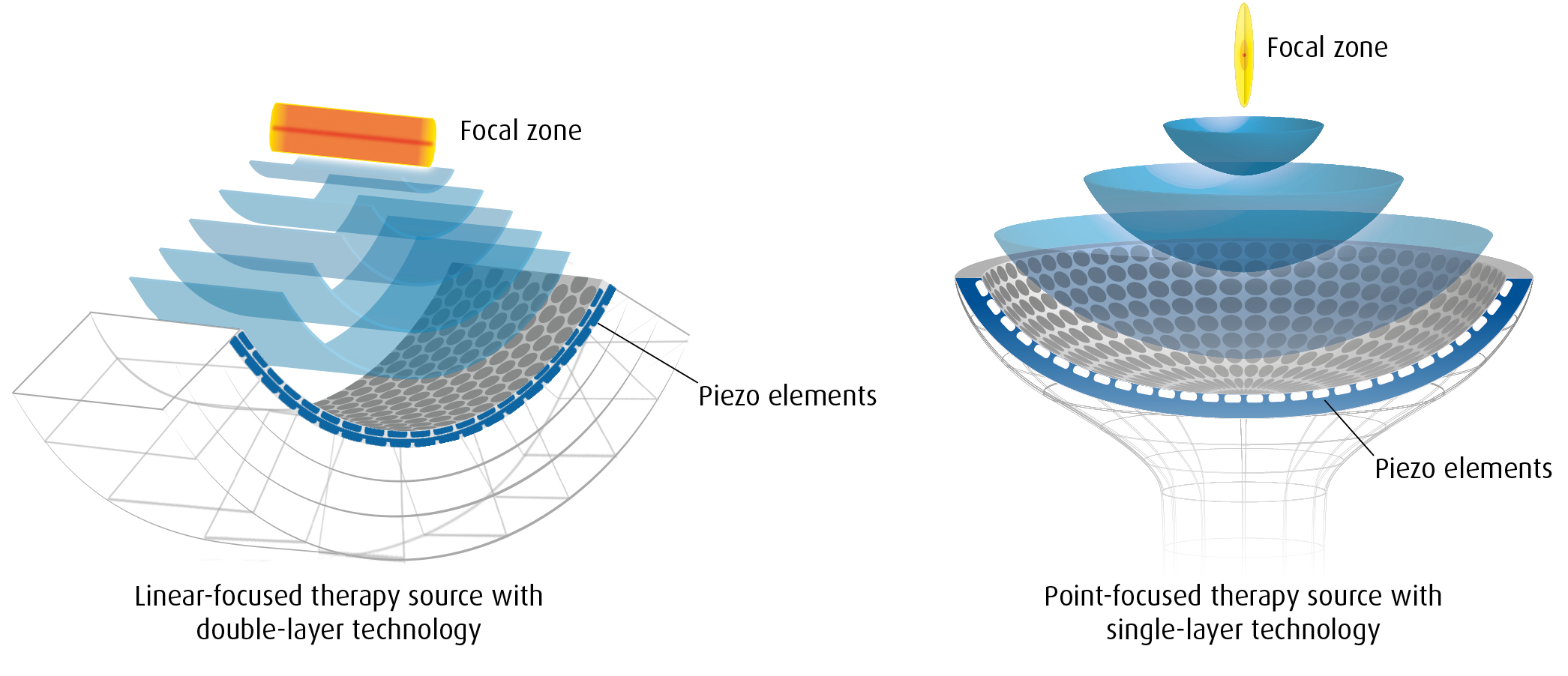 Forskellen er i lydhovedet
