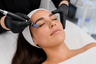 Woman receiving microneedling treatment to improve enlarged pores and skin texture in Newport Beach, California.