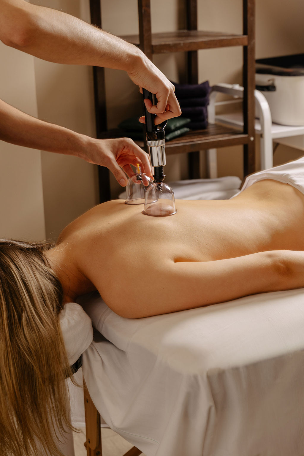 Person receiving cupping therapy on their bare back while lying on a massage table.