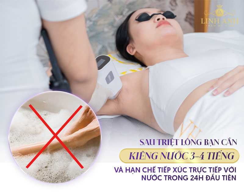 Triệt lông kiêng nước bao lâu? 