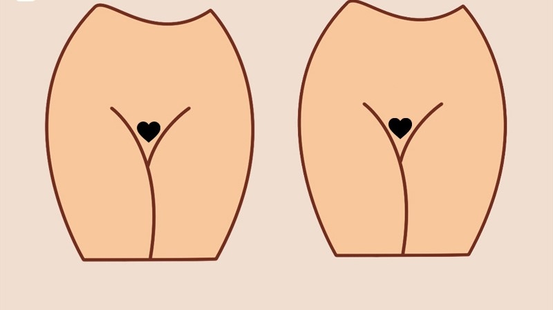 Tạo hình lông vùng kín thế nào là đẹp? 