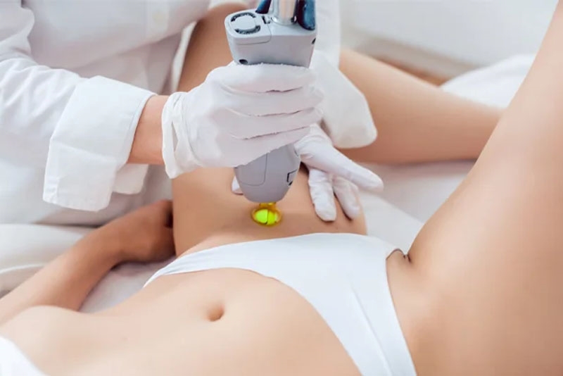 Triệt lông nách xong có được tắm không