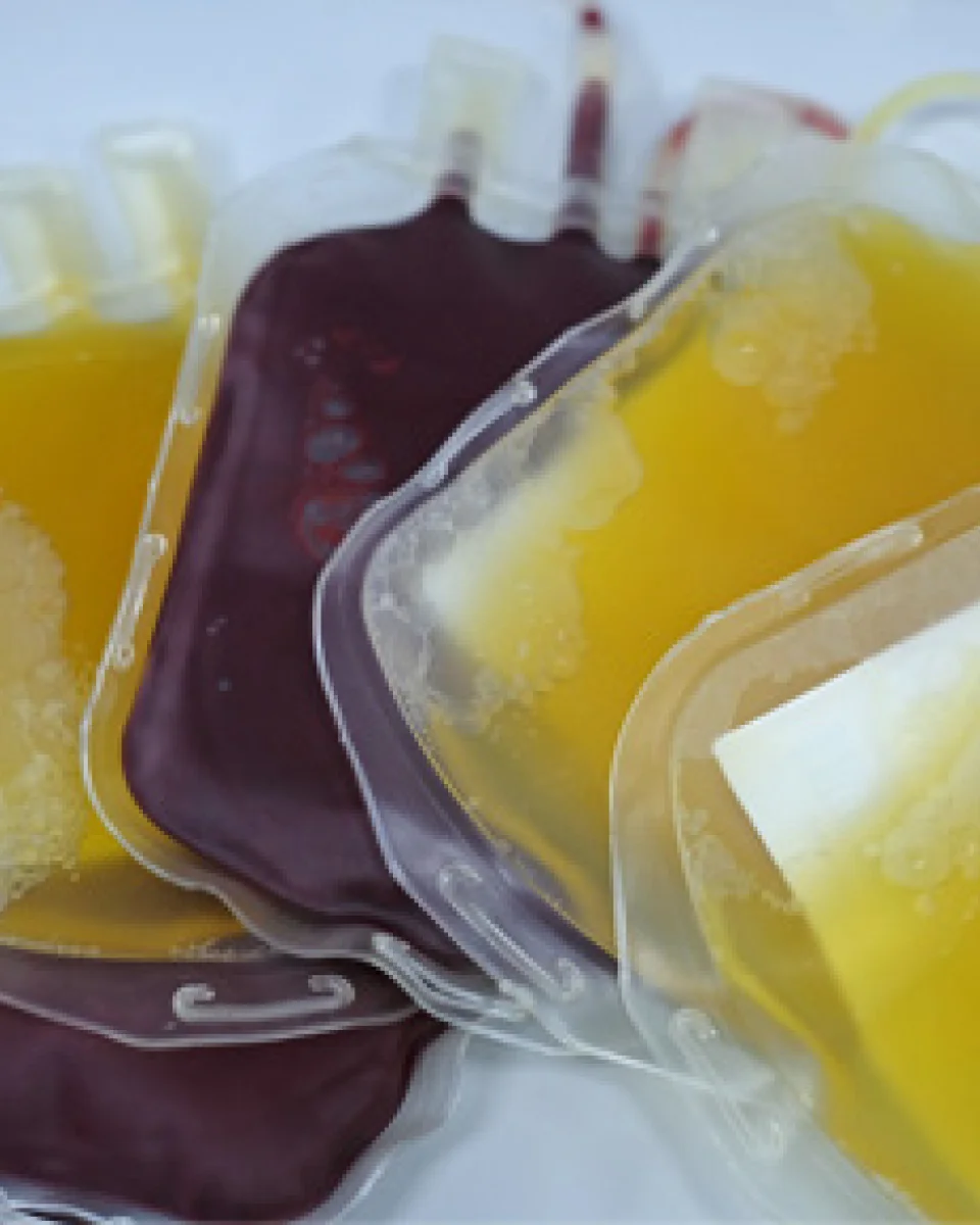 picture of a couple of bags filled with plasma and blood.