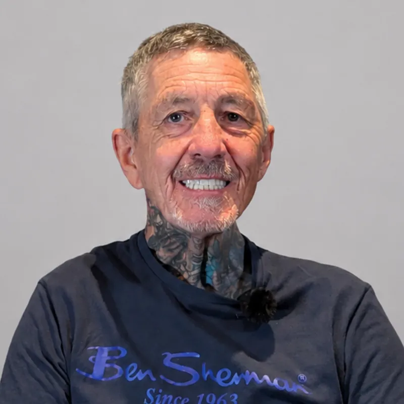 Graham smiling with his new teeth after treatment with Implantly