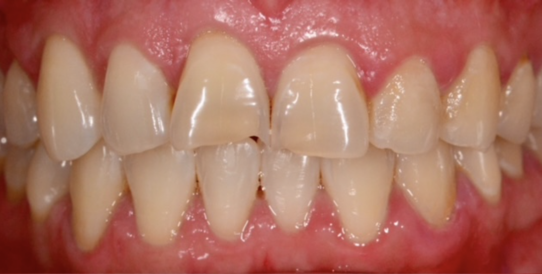 Before Image