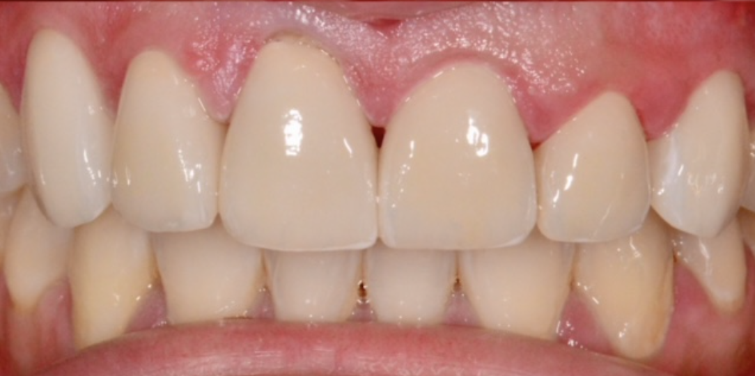 After Image