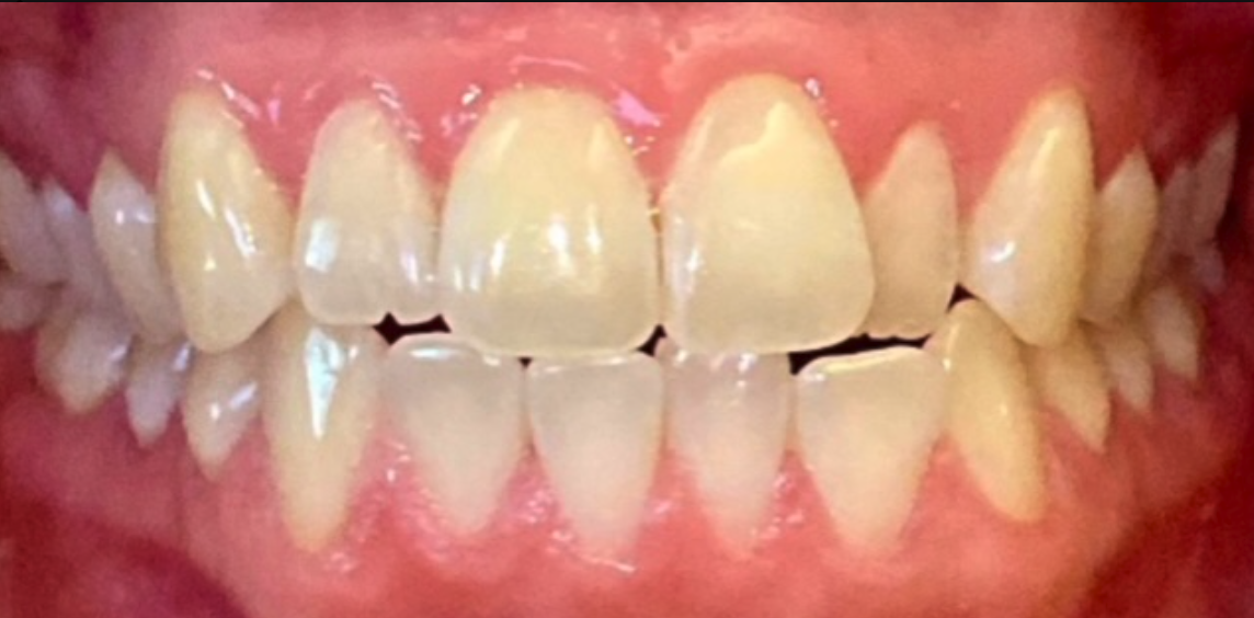 Before Image