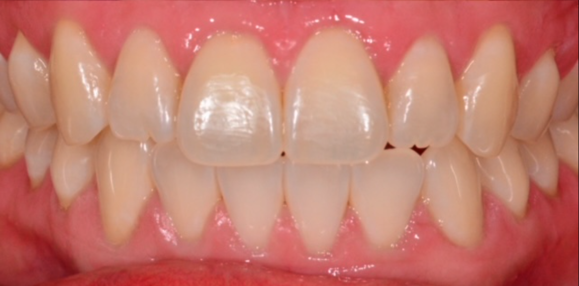 After Image