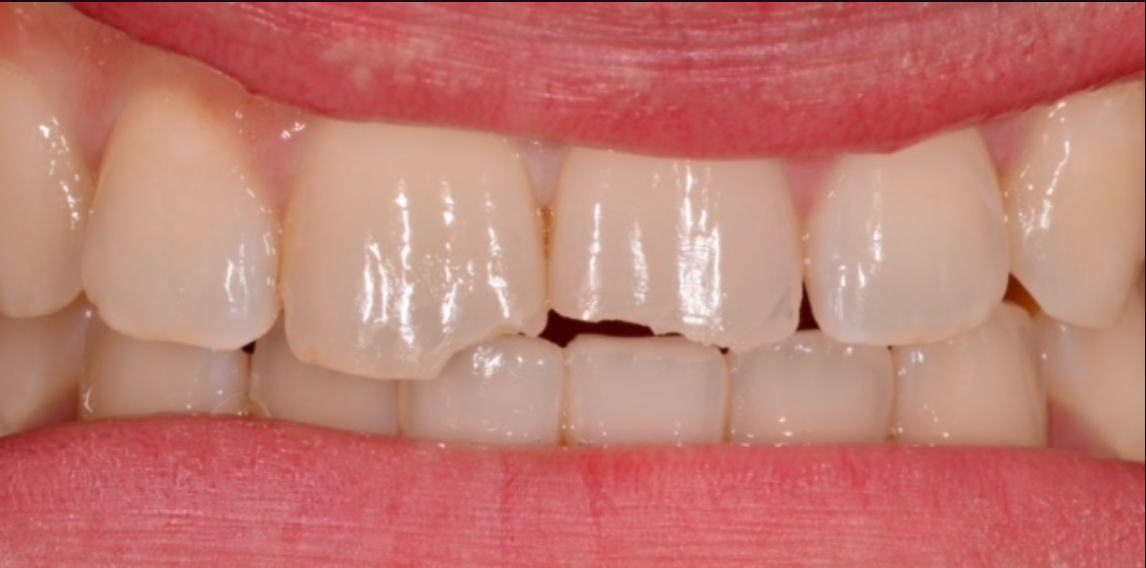 Before Image