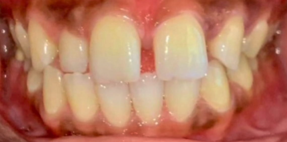 Before Image