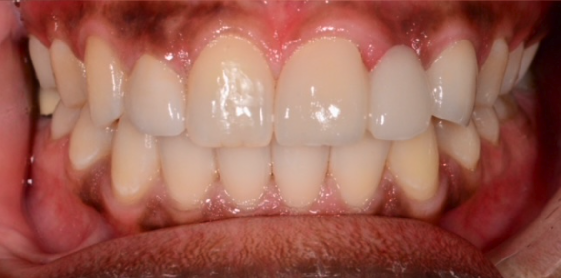 After Image