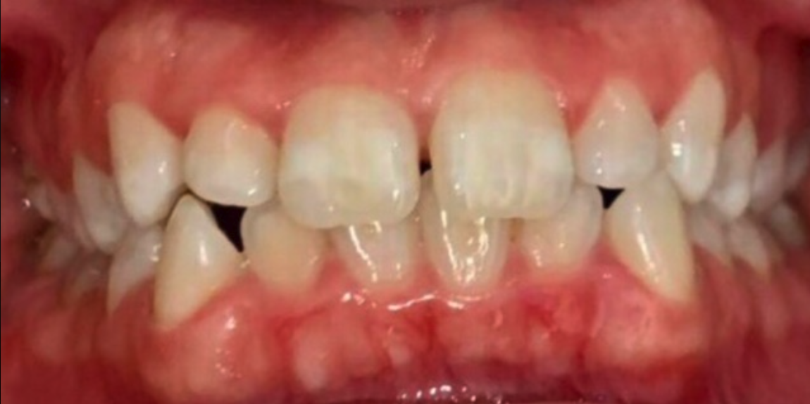 Before Image