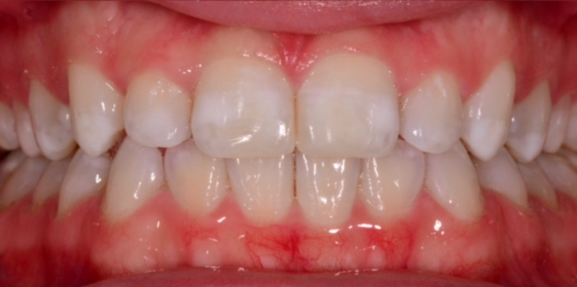 After Image