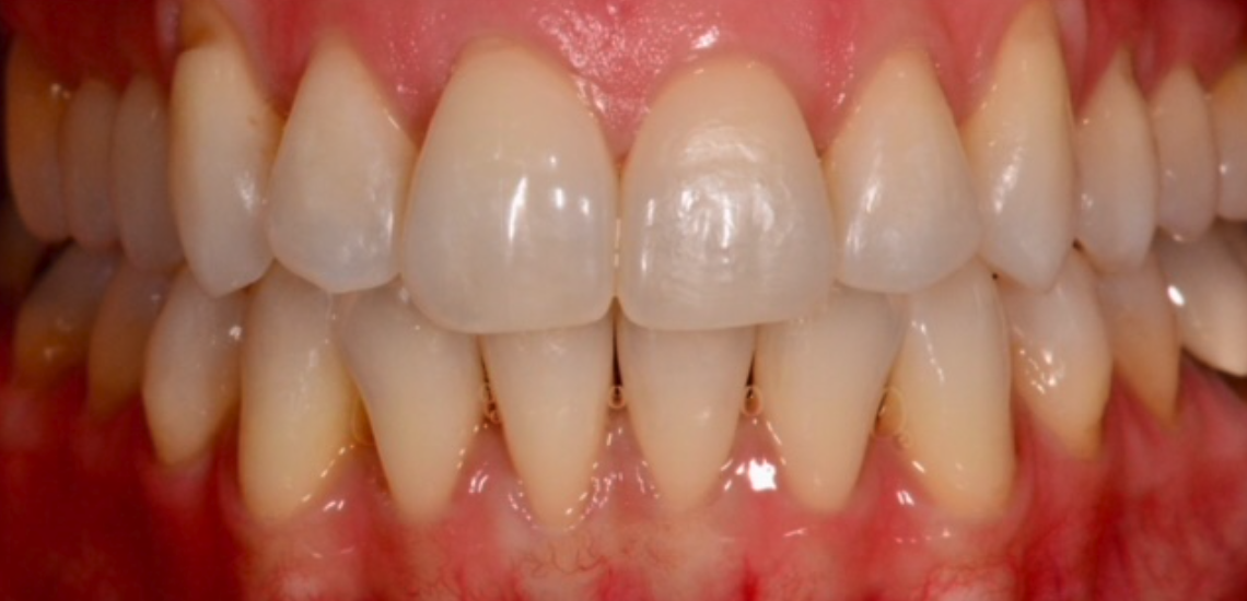 After Image