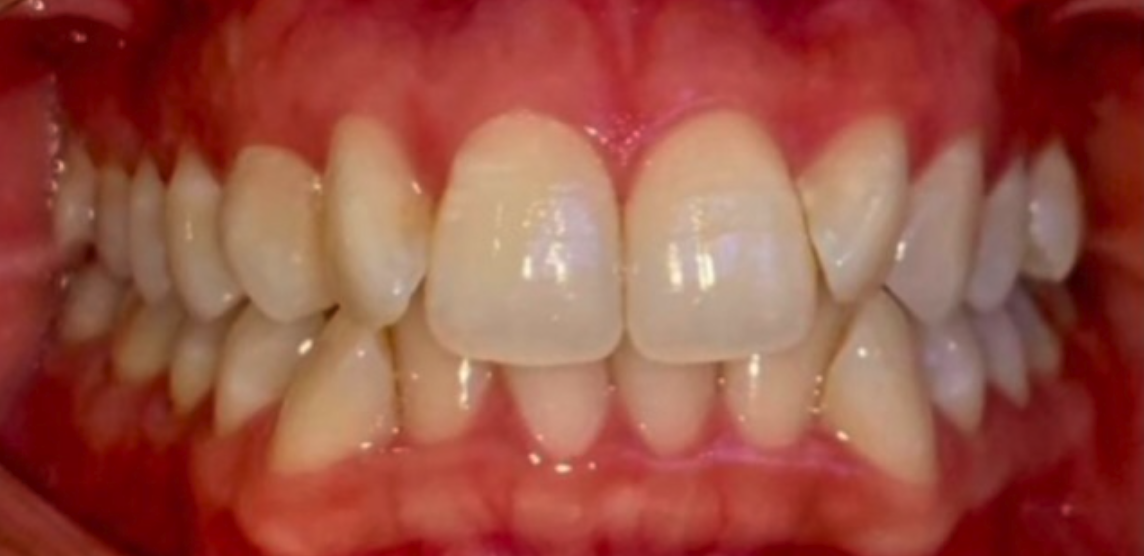 Before Image