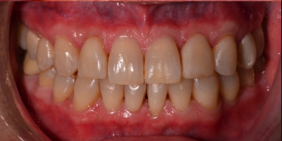 After Image