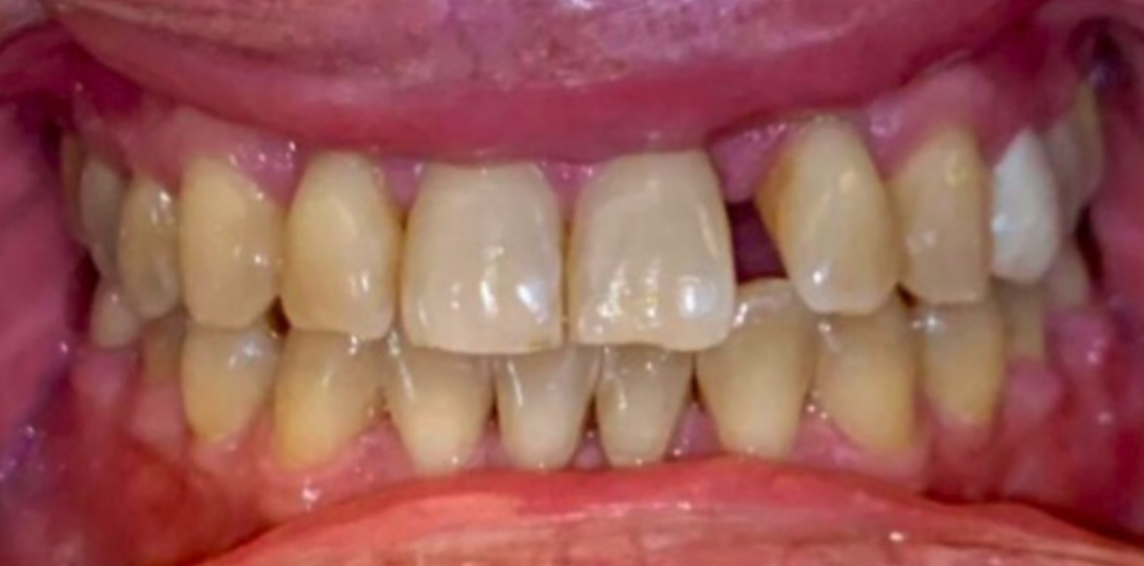 Before Image